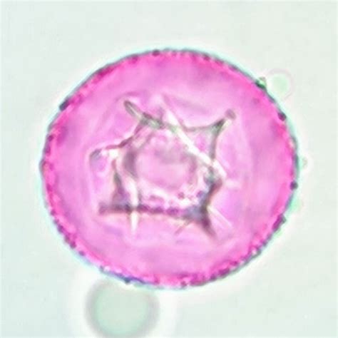 Juniper Tree Pollen Exploding に対する画像結果