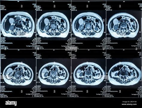 Image result for Afbeelding MRI Scan