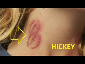 HOW TO GIVE A HICKEY FOR BEGINNERS EASY
