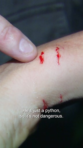 45K views · 905 reactions | Tim gets bitten by a carpet python!  #reptile #reels #wildanimals #dangerousanimals #australia #reelsviral #deadlyanimals #snakebite #australian | Untamed | Facebook