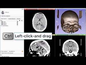 3D Slicer - new mouse mode for window/level