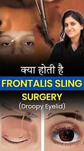What Is Frontalis Sling Surgery? | Ptosis (Droopy Eyelid) Treatment