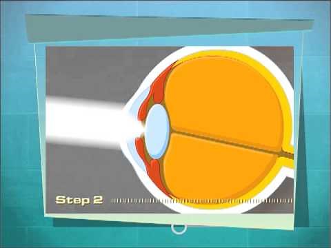 "How Light Enters The Eye" Educational Video