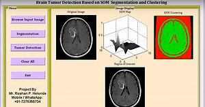 Brain Tumor Detection Using Segmentation and KNN Clustering | Brain Tumor Detection Using Matlab | Major Project with Source Code