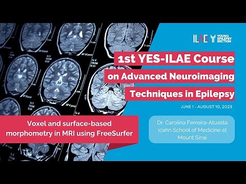 4th Lecture Surface-based morphometry in MRI using FreeSurfer