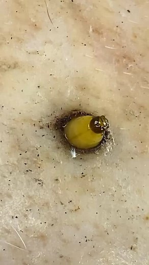 79K views · 397 reactions | A Disturbing Object Was Embedded in This Toenail P689 #toenails #pedicure #OddlySatisfying #fblifestyle #fypシ Beautiful moments of care and relaxation through a gentle pedicure experience. Simple, clean, and satisfying. ￼ ￼ Disclaimer: This video is for educational and relaxation purposes only. All content belongs to the respective owners, no copyright infringement is intended. | Hadi 05 | Facebook