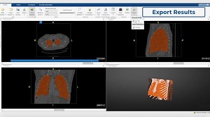Display, Segment, and Process Medical Imaging Data with MATLAB