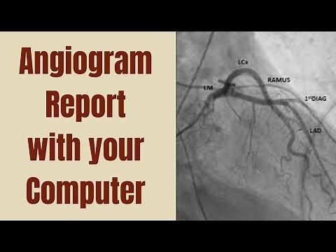 Desktop: How to Open Angiogram/Angiography Report DICOM with Syngo FV
