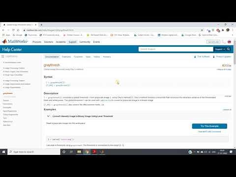 MATLAB code for threshold operation | Digital Image Processing | MATLAB