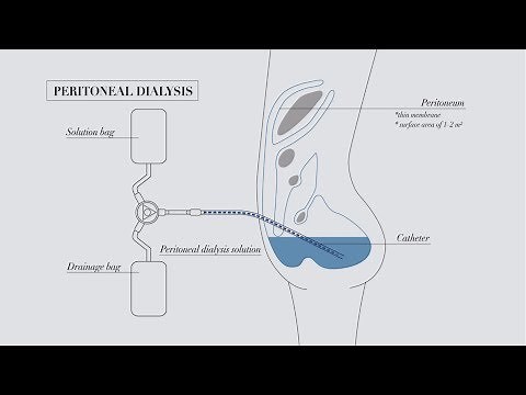 Understanding peritoneal dialysis
