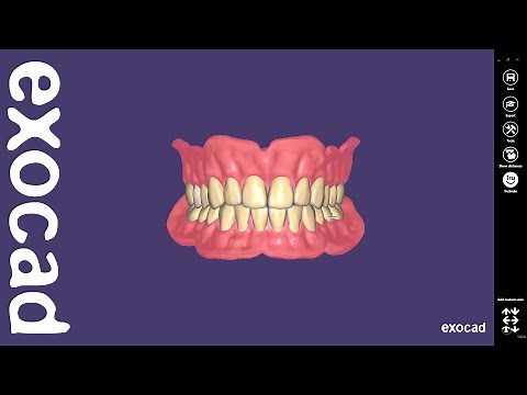 exocad Video Tutorial: Full Denture Design