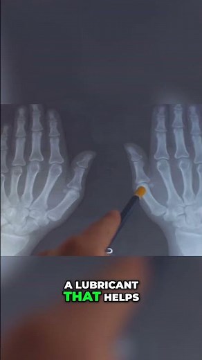 The Science of Knuckle Cracking Explained