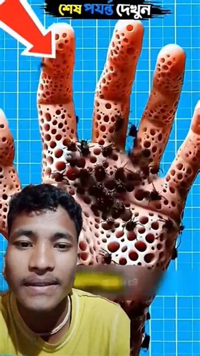 What Happens If You Get Bitten by a Spider? 😱🕷️ | Shocking Facts