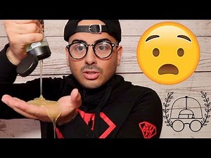 Finger weg von Haargel | Haarausfall mit 18