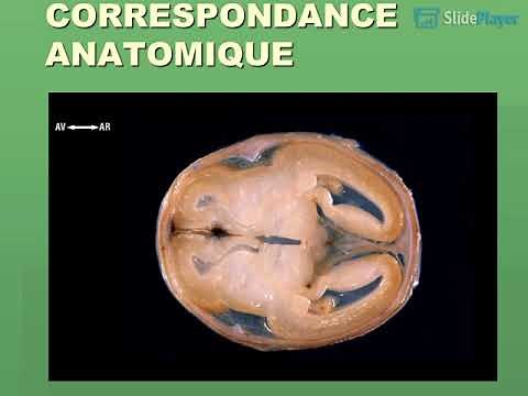 Mesures par échographie (Biométrie fœtale)