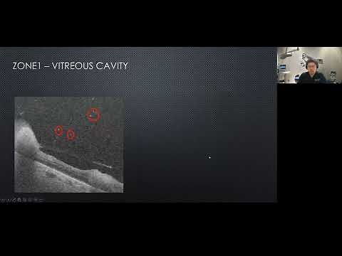 Lecture: Practical Approach to Retina OCT Interpretation 2022