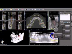 DICOM to Surgical Guide (15 Min)
