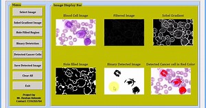 Blood / Leukemia Cancer Detection Using Image Processing Matlab Project Code || IEEE Based Project