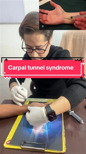 Understanding Carpal Tunnel Syndrome and Treatments