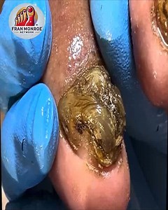 28K views · 288 reactions | Best Nail Practices for Curved Nails That Reduce Pain Naturally #NailCareTips #ToenailRoutine #HealthyNails #CleanNailsDaily | Fran Monroe | Facebook