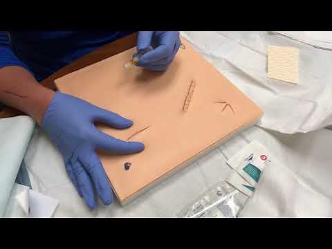 Steri-Strip Application