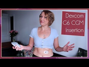Dexcom G6 Sensor Insertion
