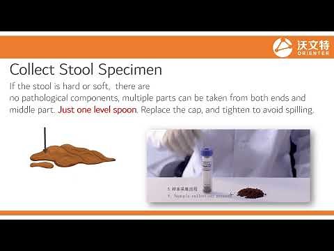 How to collect the stool sample? A stool specimen collection guidance by Orienter feces analyzer