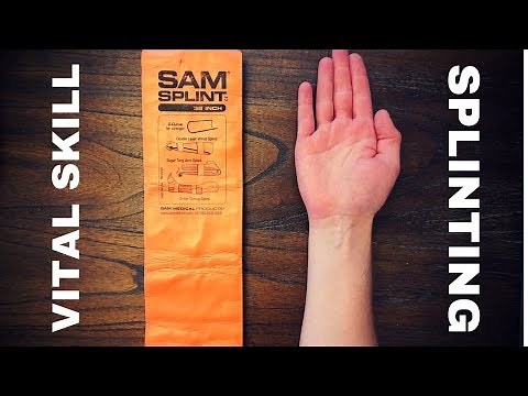 Fundamentals of Splinting