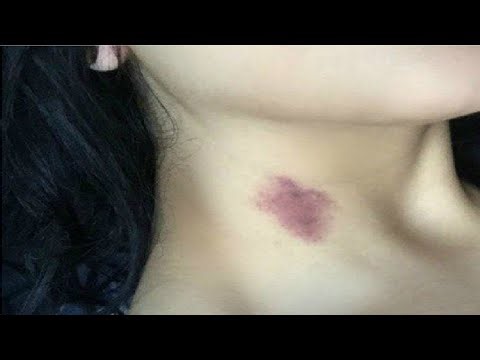 HOW TO GIVE A HICKEY STEP BY STEP GUIDE FOR BEGINNERS