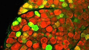 Columbia Researchers Create New Model of ALS