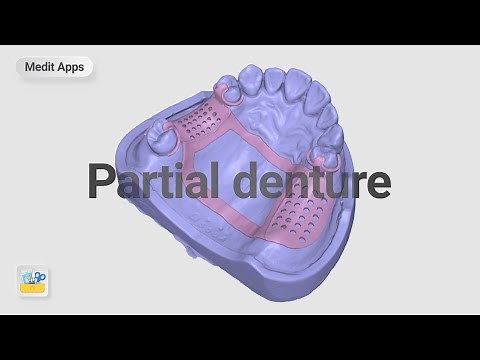 Designing a Partial Denture Framework with Medit Design App