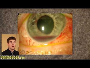 Exploding Eye Lecture (Video) - TimRoot.com