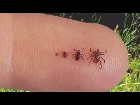Doctor explains what you should know about ticks