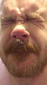 Infection. Pus - face pops!