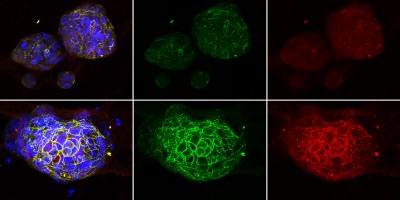 Precision Reprogramming: How AI Tricks Cancer’s Toughest Cells | Newswise