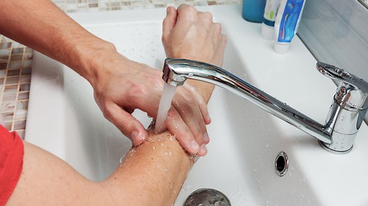 How to Treat a Burn at Home: A Step-by-Step Guide - GoodRx