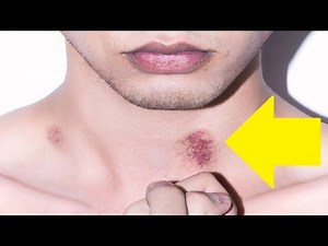how to give a hickey for beginners easy tips