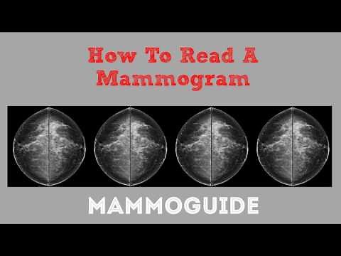 How To Read A Mammogram