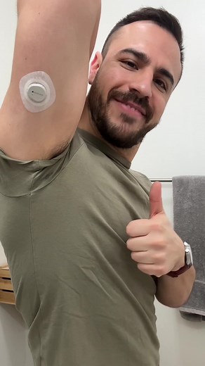 Proper Dexcom G7 Sensor Placement Tips for Extended Use