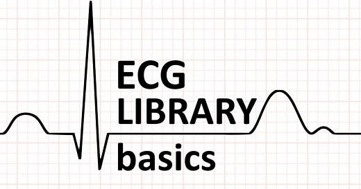 ECG Interpretation: The Basics