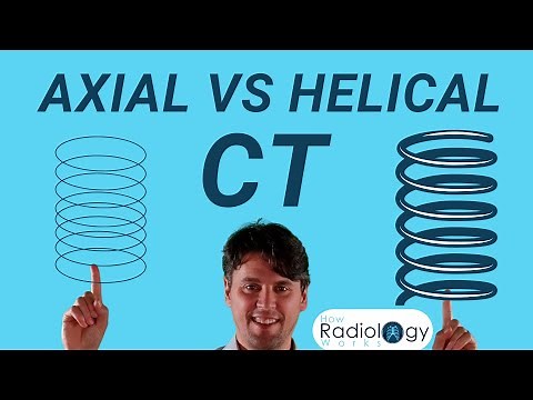 CT Scan Modes Compared (Axial vs Helical)