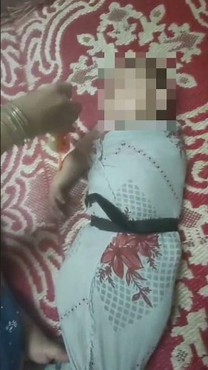 1.5 Months of Progress: Erb's Palsy Recovery with Early PBPA Protocol approach @leadphysio