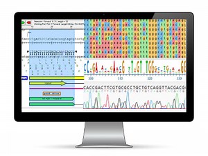 Pairwise Sequence Alignment Workflow | DNASTAR