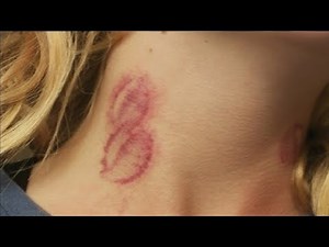 how to give a hickey fast and easy step by step