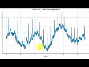 ECG Signal Denoising in Python | Baseline Wander Removal with Wavelets