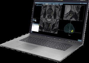 ProMap® Lite | KOELIS