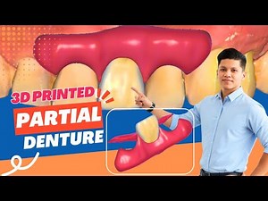 3D Printed Removable Partial Denture Design | Exocad Splint File Workflow | Ratanician