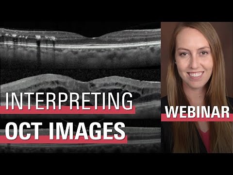 Ordering and Interpreting Retinal OCT Images