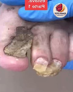 86K views · 696 reactions | How American Seniors Maintain Healthy Aging Feet Using Safe Home Products #FootSupport #DiabeticFootCare #WellnessSeniors #EverydayCare | Tots Mags Wheel | Facebook