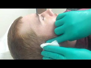 Cyst explosion!!!! Nurse down!